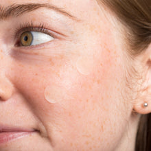 Parches para granos NIGHT Silk Microdart, 48 unidades