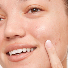 Toallitas húmedas para el acné con ácido salicílico Peace Out, paquete de 60 unidades