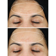 Sérum de retinol StriVectin Super C, 1.0 fl oz + 0.5 fl oz