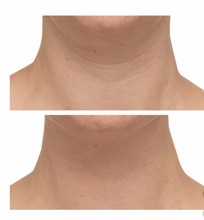 StriVectin TL Advanced Tightening Neck Cream Plus, 1 oz, 2-pack