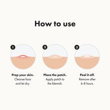 Hero Cosmetics Mighty Patch Mega Pack, 84 ct.