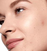 Peace Out Salicylic Acid Acne Day Dots, 60-pack