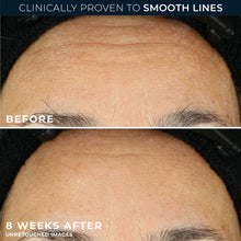 RoC-Retinol-Correxion-Capsules-A3 - Brands For Less USA
