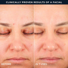RoC Line Smoothing 2-Step Retinol Peel Pads, 36 ct.