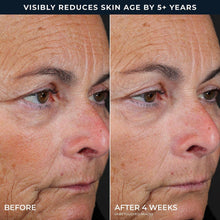 RoC Line Smoothing 2-Step Retinol Peel Pads, 36 ct.